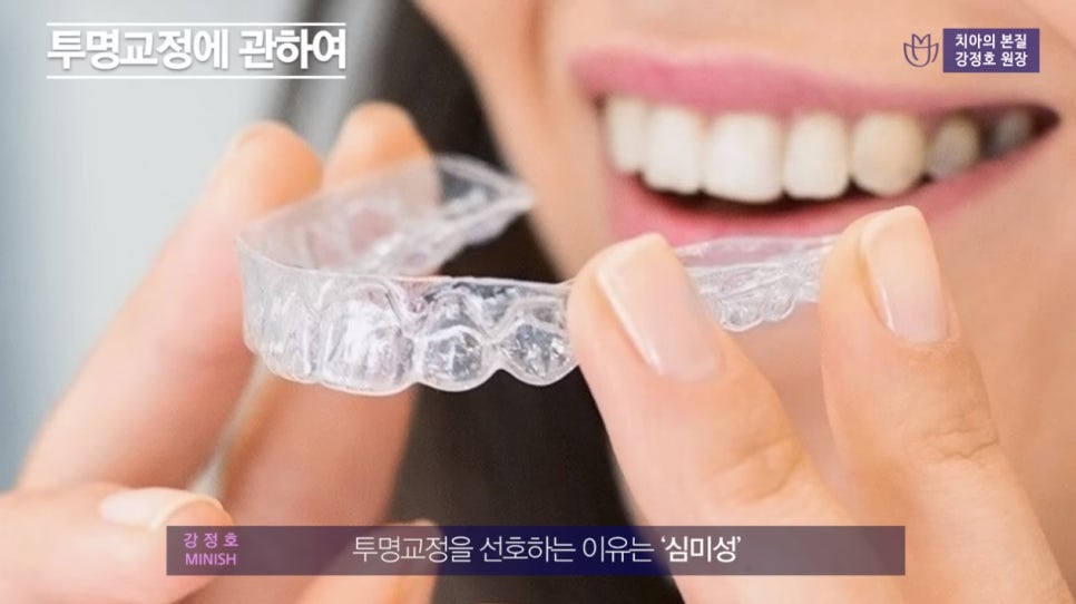 치아교정 앞둔 당신이 반드시 알아야 할 점① - 인비절라인 편 관련 이미지 6