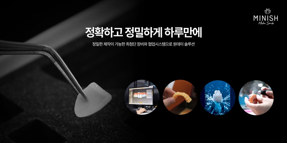 벌어진 앞니 치료 방법 세가지 장단점 관련 이미지 10
