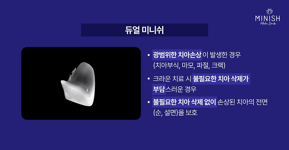 방치하면 큰일! 치아부식 증상 원인 치료 방법엔? 듀얼미니쉬 관련 이미지 5