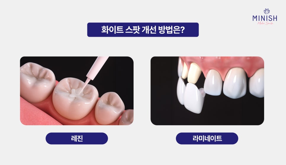 White Spots: Improve Stained Teeth Naturally with Minish! image 4