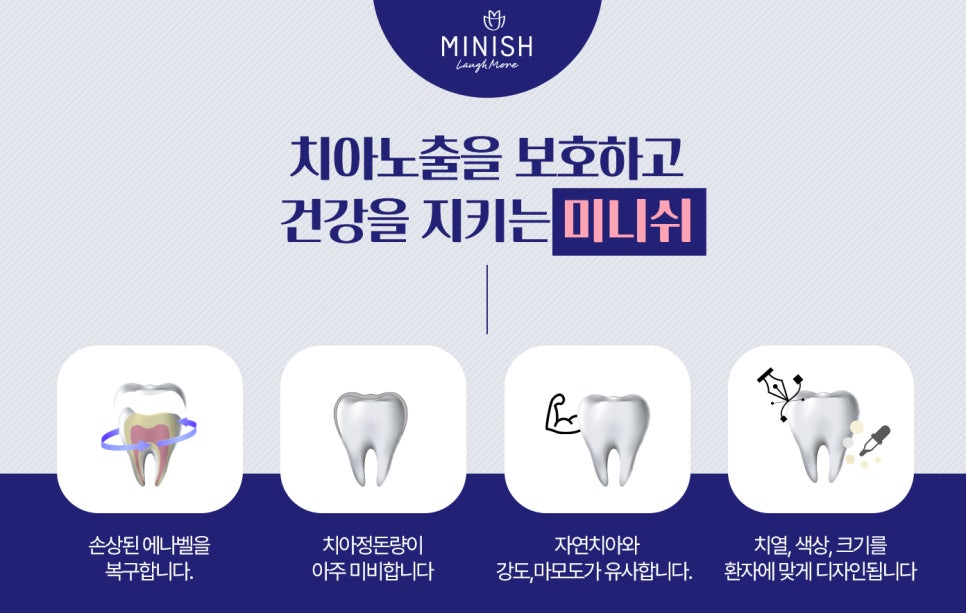 닳고 시린 치아를 구해주는 치료법, 미니쉬 관련 이미지 4