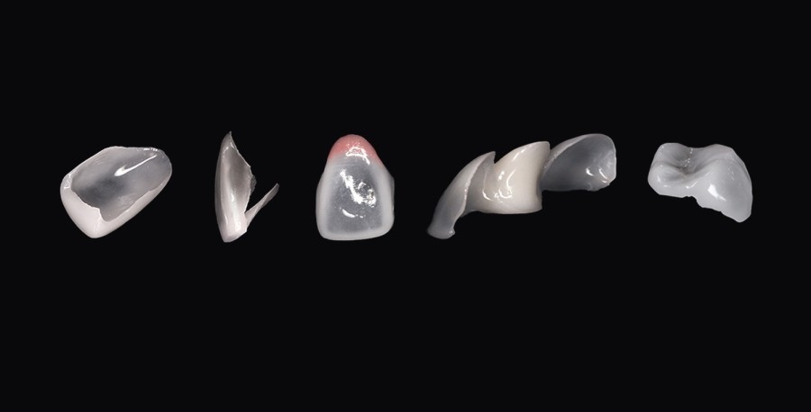 강남구청치과 건강한 아름다움, 미니쉬로 활짝 핀 자신감을 선물해 드립니다 관련 이미지 2