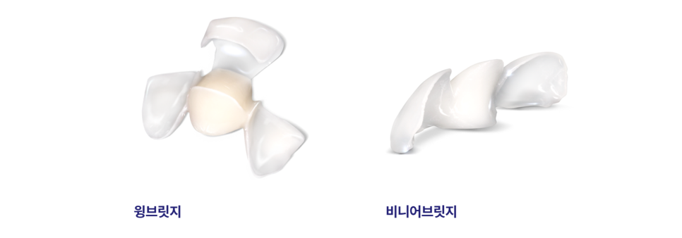 충치 근본 원인을 해결하는 미니쉬를 활용한 충치치료 관련 이미지 8