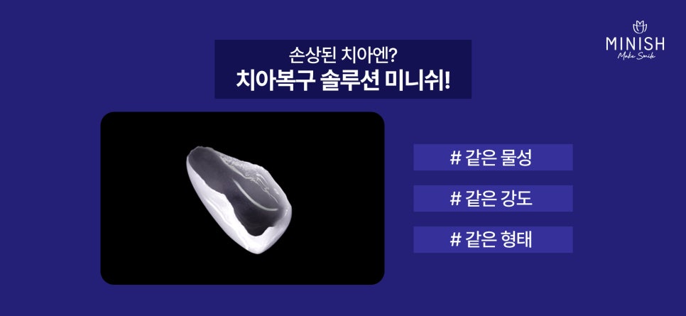 앞니깨짐 레진 치료의 한계와 치아복구솔루션 미니쉬 특장점 관련 이미지 4