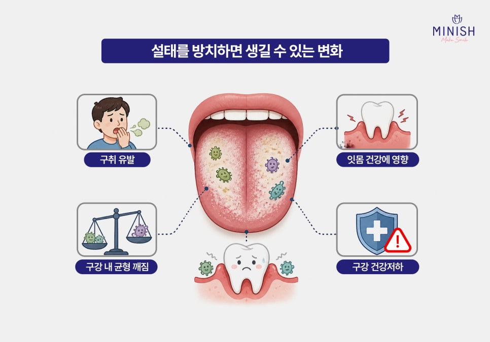 혀가 하얀이유는 뭘까? 혀설태 원인과 혀클리너 사용법 정리 관련 이미지 3