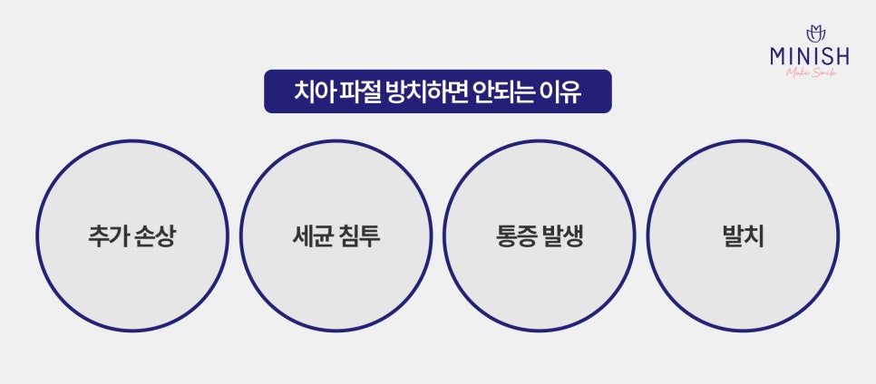 치아 파절? 치아가 깨졌다면 미니쉬로 건강과 심미성을 모두 복구하세요! 관련 이미지 2