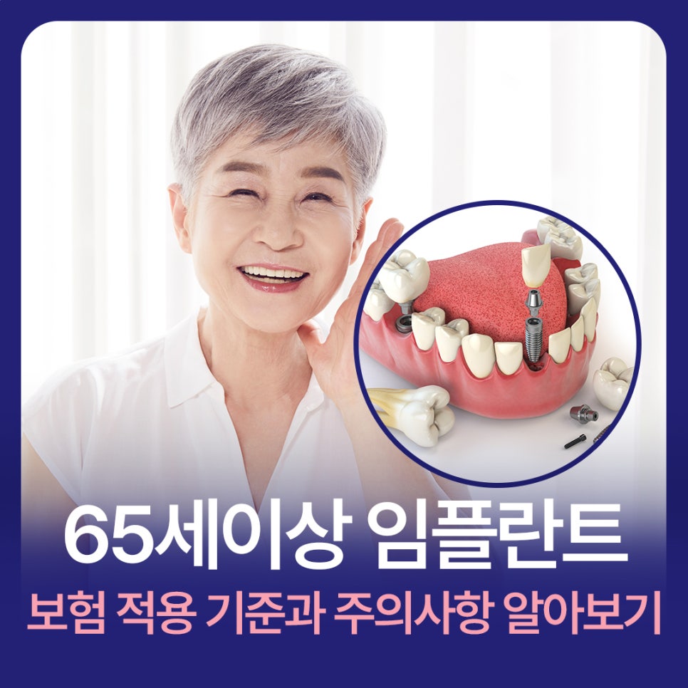 65세이상 임플란트 보험 적용 나이 기준과 주의사항 알아보기 관련 이미지 1