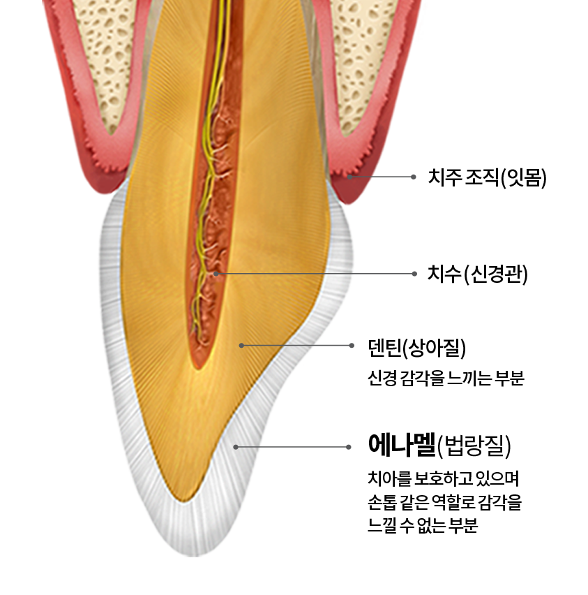치아마모, 벌어짐 등 노화 증상을 겪는 50대를 위한 학동치과 관련 이미지 5