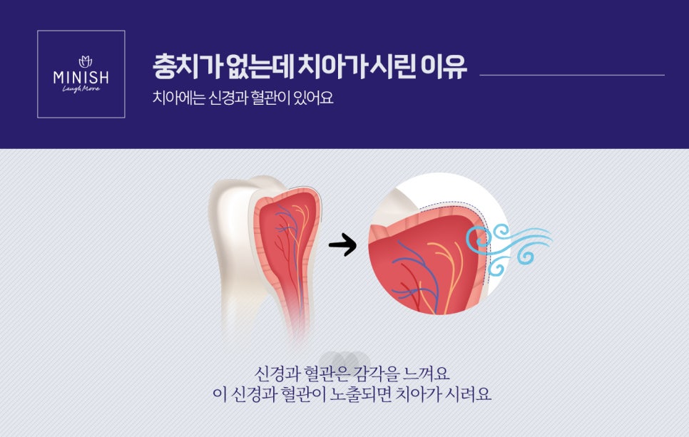 치아건강 지키는 치아관리1편 - 이런 치약 쓰지 마세요! 관련 이미지 3