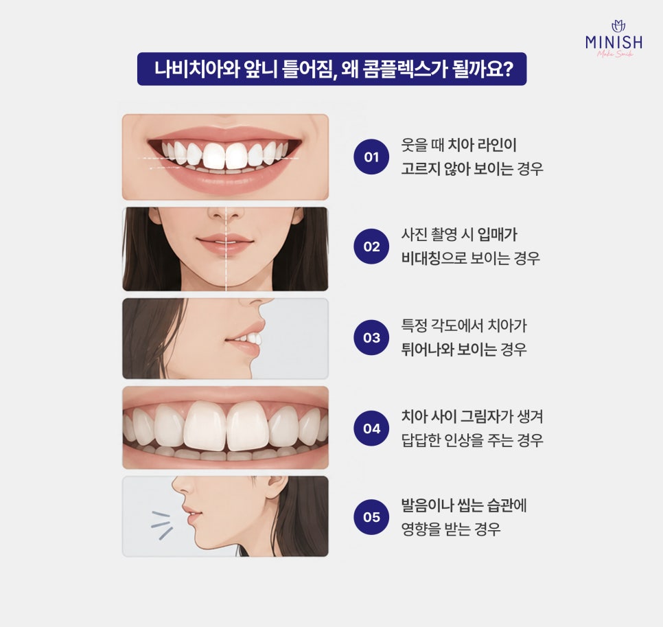 Crooked Front Teeth and the Butterfly Teeth Complex: Why Improving Tooth Shape and Proportions Matters / Minish Line image 3
