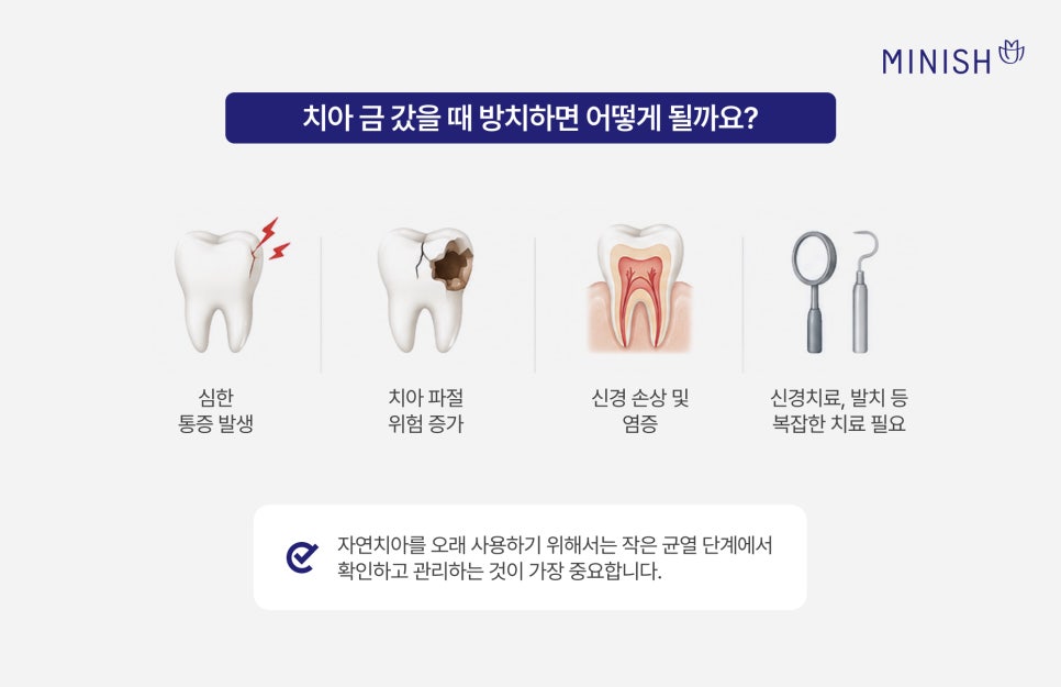 Problems That Can Occur If a Cracked Tooth Is Left Untreated and Ways to Preserve Natural Teeth image 4