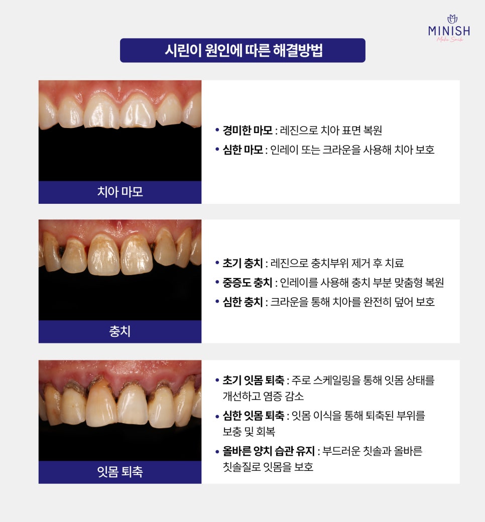 My Teeth Hurt When They’re Sensitive: Causes, Symptoms, and How to Resolve It image 4