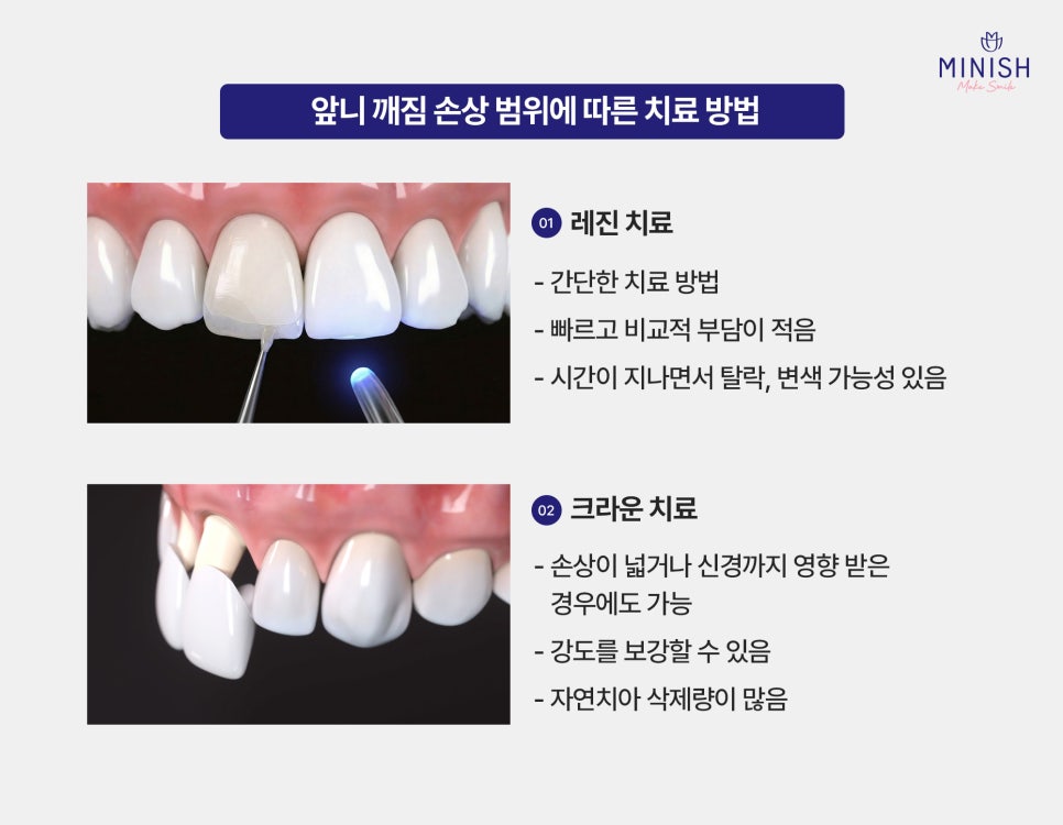 What Problems Can Occur If a Chipped Front Tooth Is Left Untreated, and How Can It Be Restored to Look Like a Natural Tooth? image 4