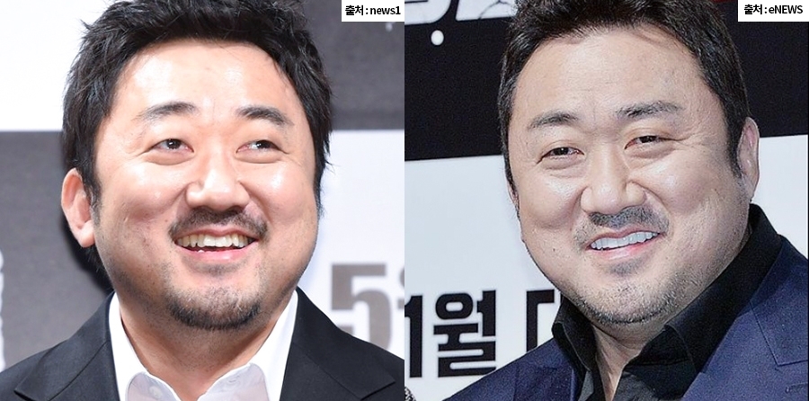 치아교정 고민, 미니쉬하모니로 관련 이미지 2
