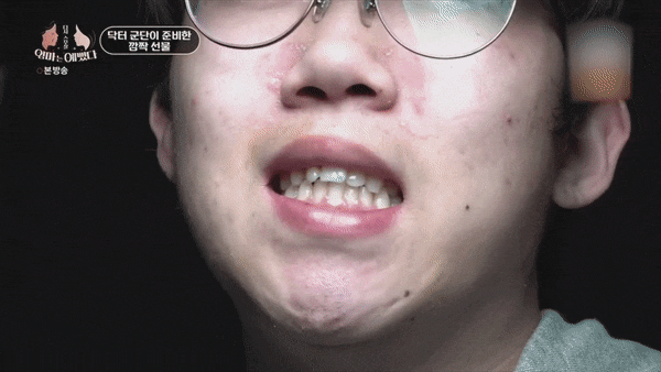 가평엄마 아들의 결손치, 미니쉬로 복원! [엄마는 예뻤다] 관련 이미지 6