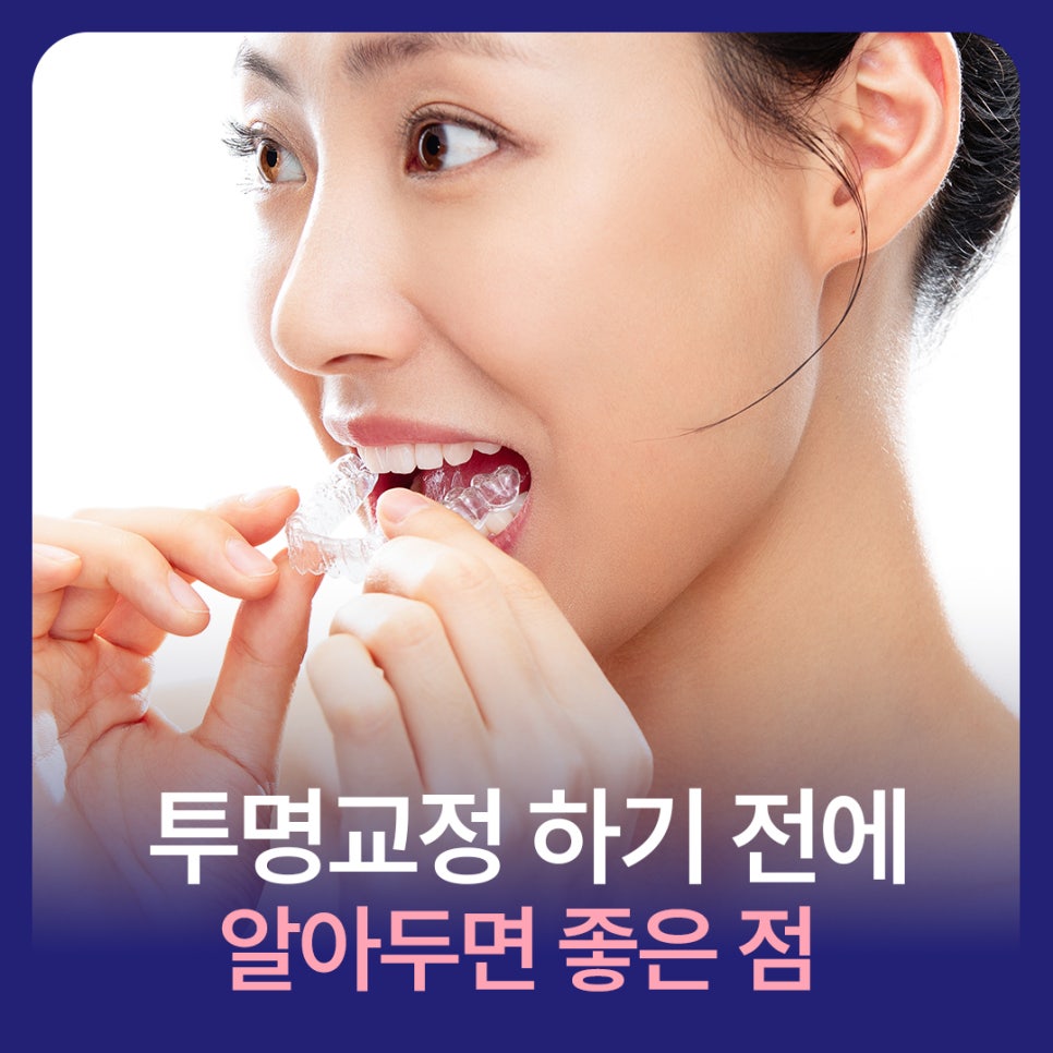 잘 보이지 않는 투명교정 하기 전에 알아두면 좋은 점 관련 이미지 1