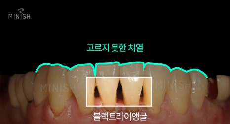 불행한 가정사를 딛고, 웃게 해준 관련 이미지 8