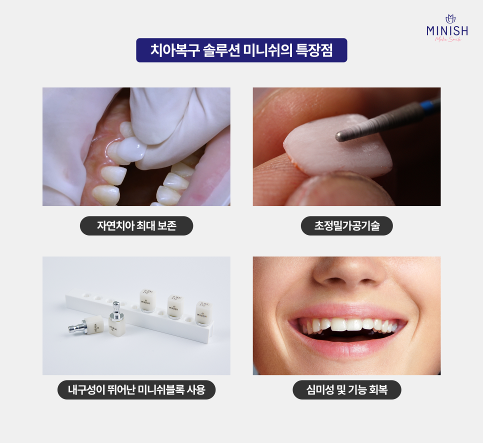 Tooth Erosion: If Left Untreated, It Can Lead to Bigger Problems! Learn About the Causes and Treatment Options image 5
