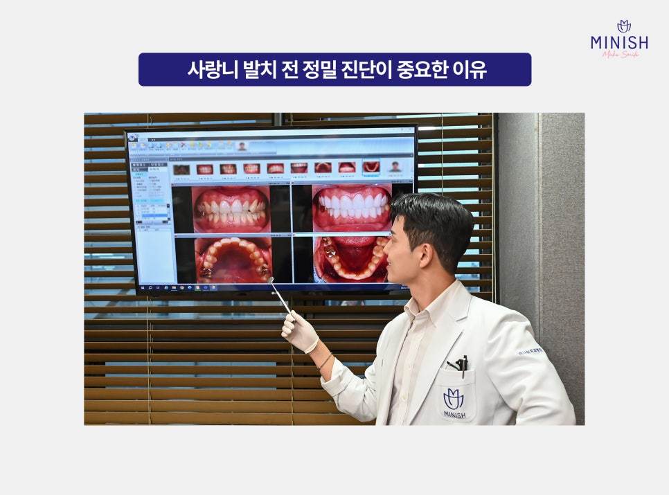 사랑니 염증 붓기 고름 반복된다면? 발치 치료 시기 체크 관련 이미지 5