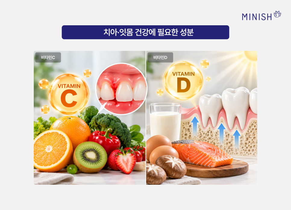 잇몸영양제 치아영양제 효과 있을까? 추천 성분은? 관련 이미지 3