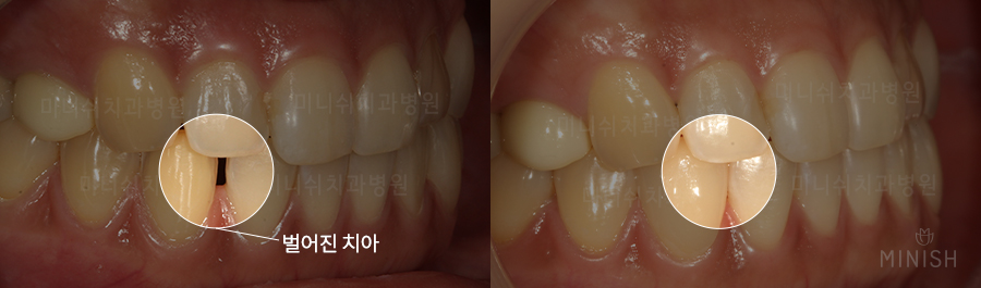 꽃게엄마와 꽃게딸, 미니쉬로 찾은 행복한 미소 [엄마는예뻤다] 관련 이미지 12