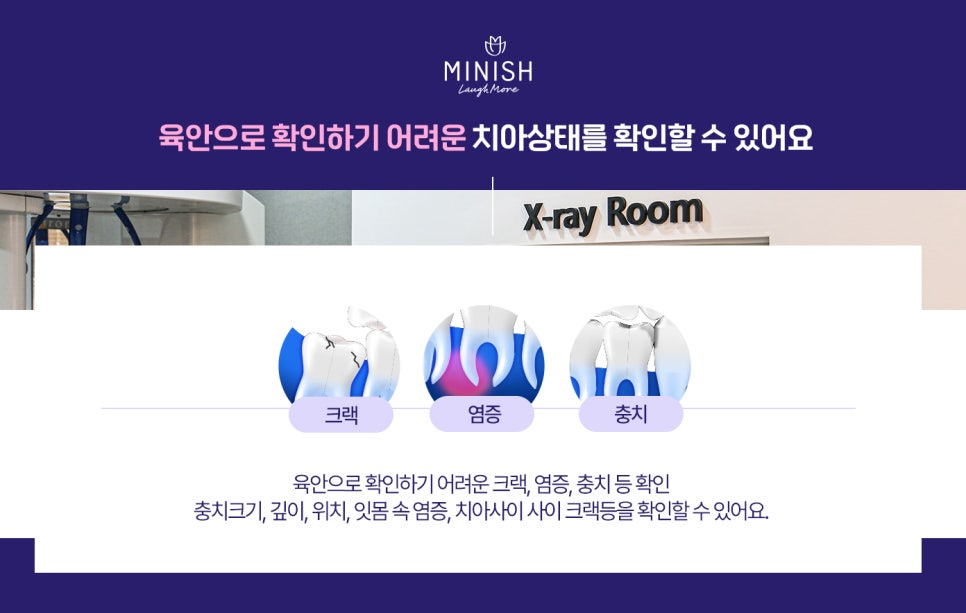 치과엑스레이는 내원할때마다 왜 촬영하는 걸까?😮 관련 이미지 3