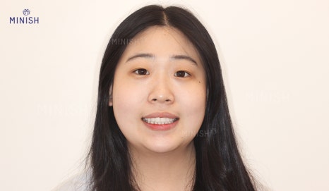 힘들게 살아온 모녀의 치아가 이렇게 변했다! | 엄마는예뻤다 관련 이미지 3