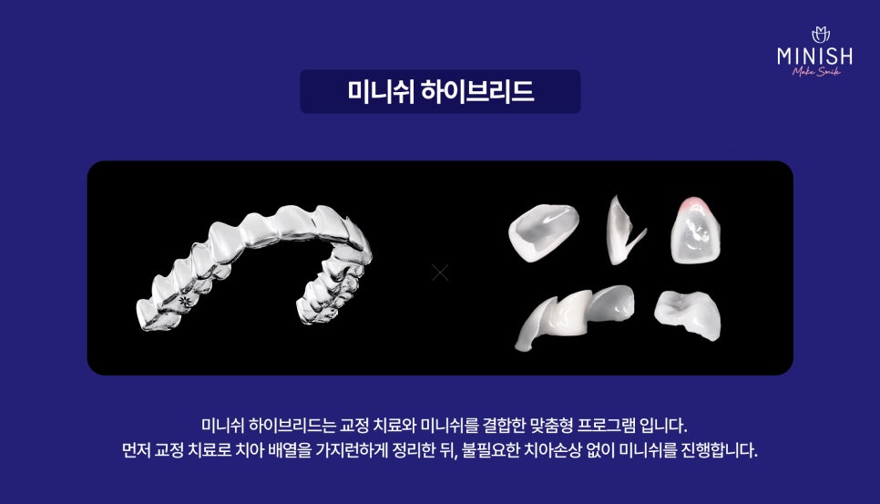 A Complete Guide to the Minish Program That Fits My Teeth image 8