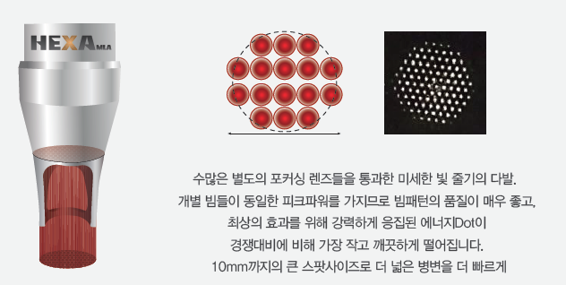 피코 레이저의 베스트셀러, 피코케어 도입 관련 이미지 5