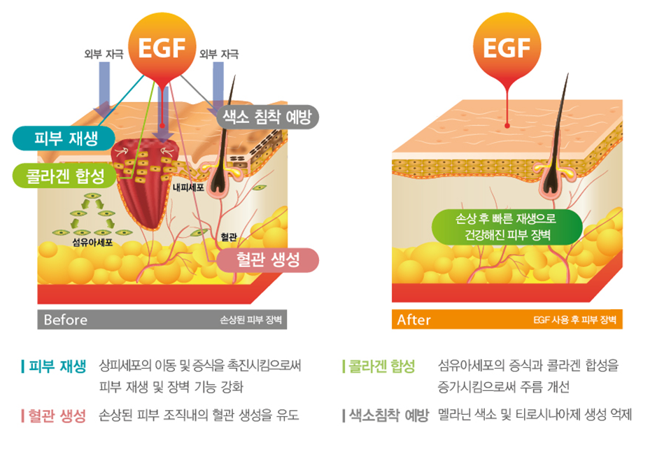 아테미스 Artemes 여신주사의 비밀 관련 이미지 4