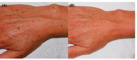 아테미스 Artemes 여신주사의 비밀 관련 이미지 6