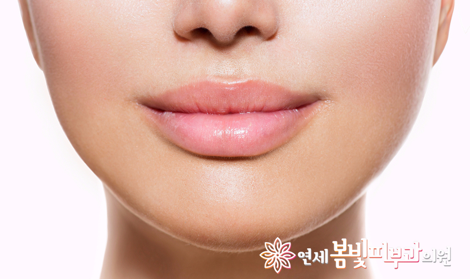 입술 필러로 티 안나게 예뻐지기~ 관련 이미지 1