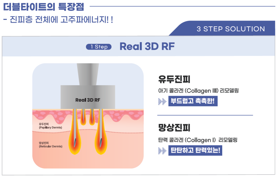 더블타이트 (Double Tite) 도입 안내 관련 이미지 5