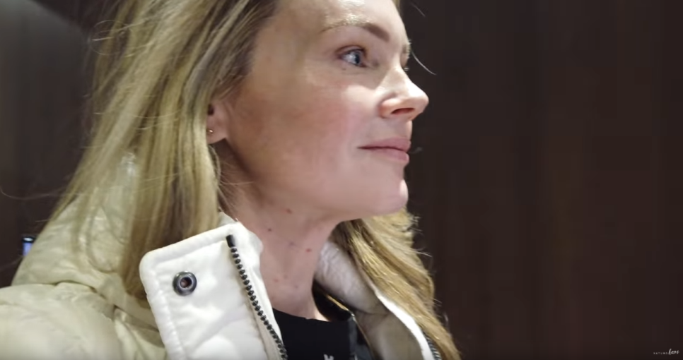 해외 뷰티 유투버 Natural Kaos 방문 및 시술 관련 이미지 14