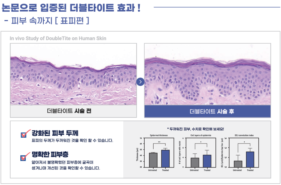 더블타이트 (Double Tite) 도입 안내 관련 이미지 9