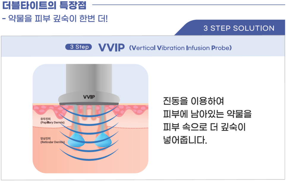 더블타이트 (Double Tite) 도입 안내 관련 이미지 7