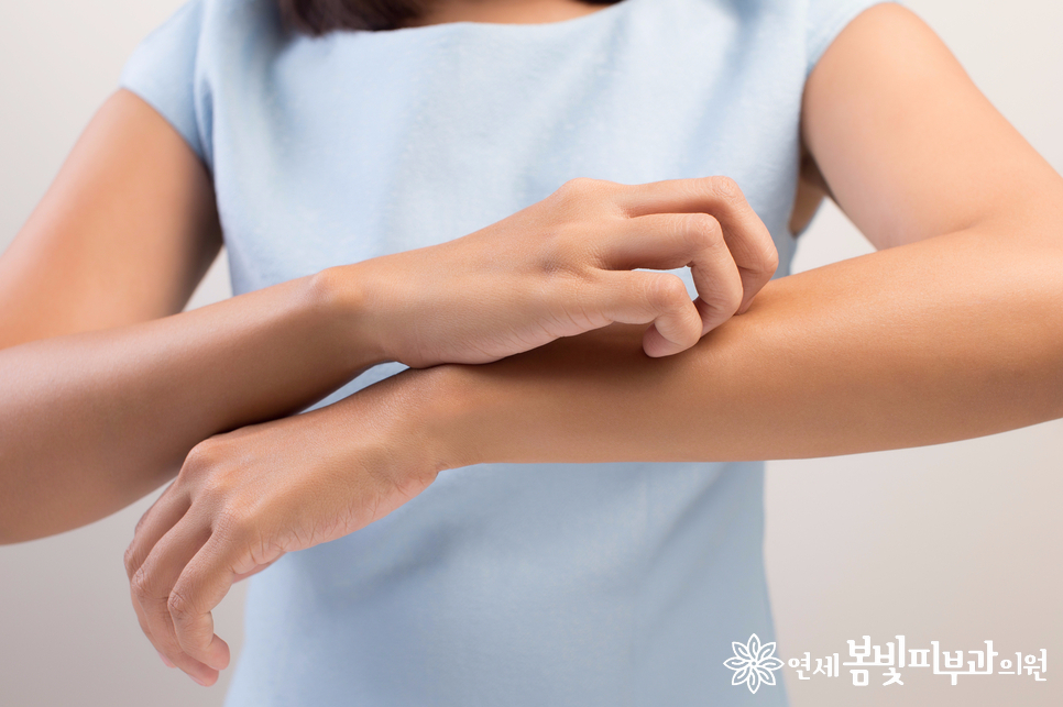 아토피피부염 환자의 가을, 겨울철 피부 관리 관련 이미지 2