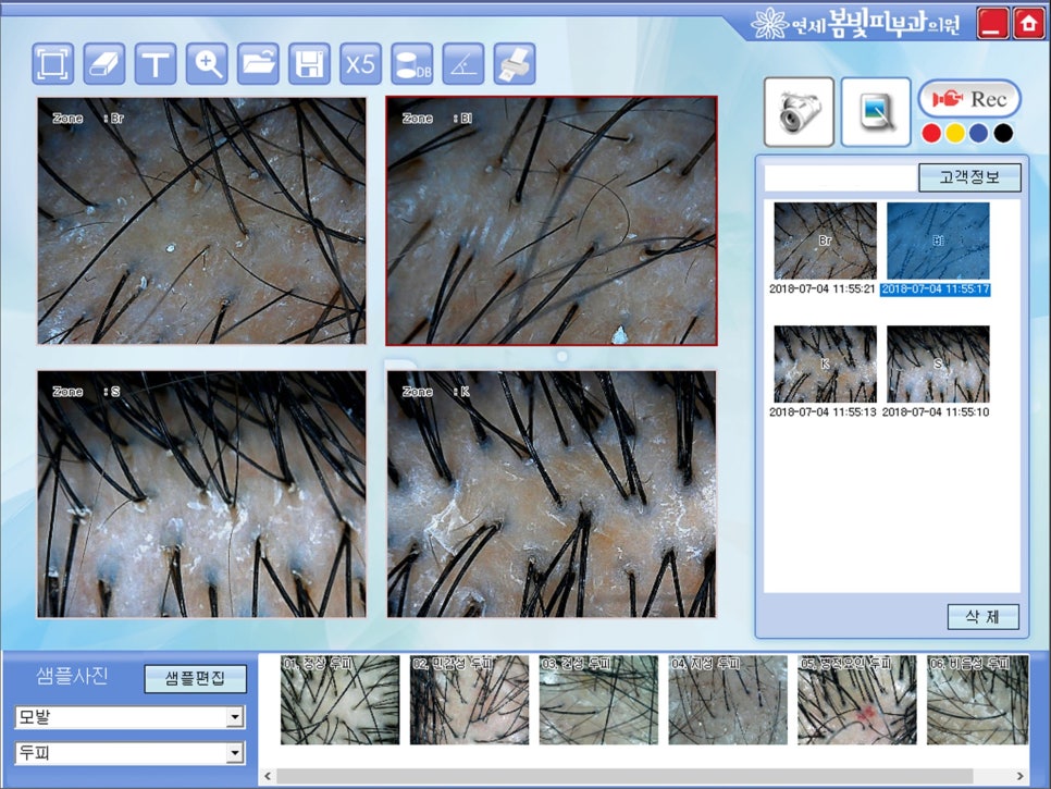 휴지기 탈모, 걱정하지 마세요! 관련 이미지 4