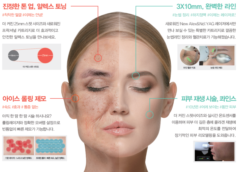 새로운 듀얼 장파장 클라리티II 레이저 도입 관련 이미지 2