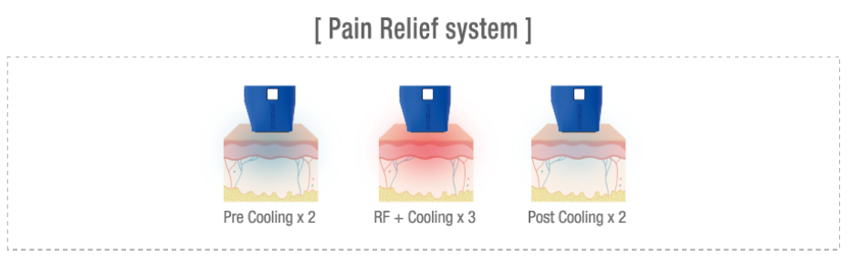 텐써마 (10 Therma) 도입 안내 관련 이미지 5