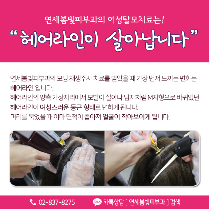 여성탈모, 여자앞머리탈모 치료 구로피부과 연세봄빛피부과에 맡기세요. 관련 이미지 5