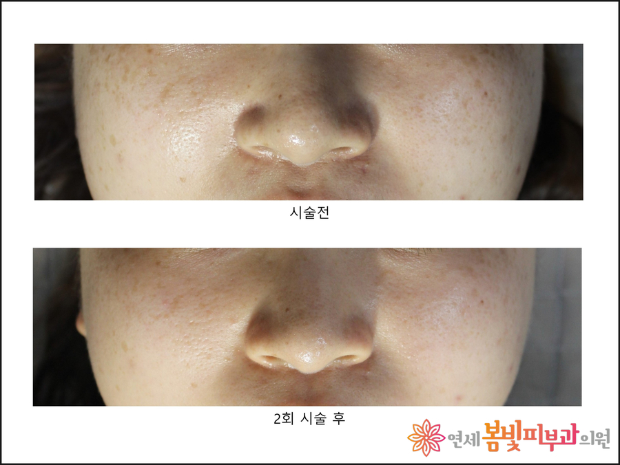 아테미스 Artemes 여신주사의 비밀 관련 이미지 7