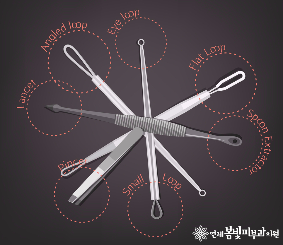 여드름과 이별하는 방법 관련 이미지 5