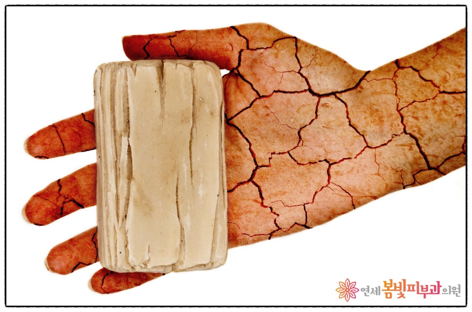 겨울철 생기는 피부건조증, 건성습진  #2 (피부보습관리, 올바른 목욕법) 관련 이미지 1