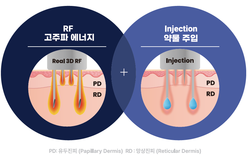 더블타이트 (Double Tite) 도입 안내 관련 이미지 3