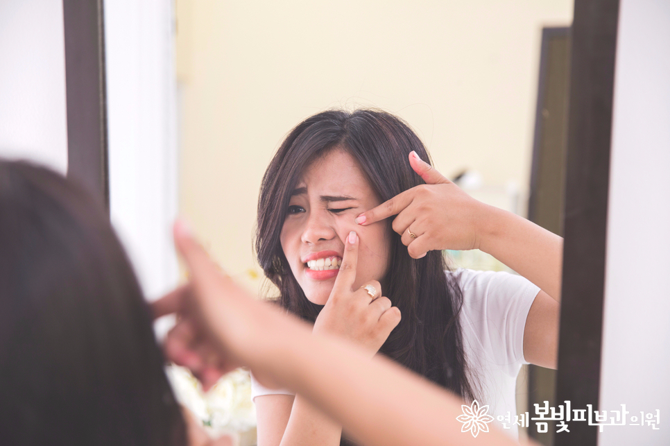 여드름과 이별하는 방법 관련 이미지 1