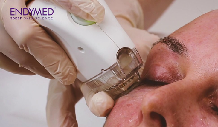 엔디메드 3DEEP Pure+ 2.0 도입 안내 관련 이미지 5