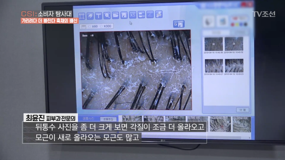 TV조선 <CSI:소비자탐사대> "흑채의 배신" 인터뷰 진행 관련 이미지 6