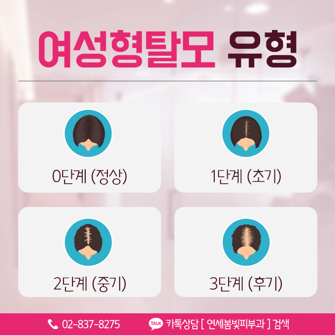 여성탈모, 여자앞머리탈모 치료 구로피부과 연세봄빛피부과에 맡기세요. 관련 이미지 6