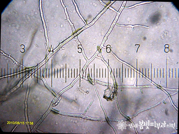 길냥이 엄마들에게 찾아오는 불청객, 링웜! 관련 이미지 3